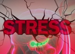 Stress!