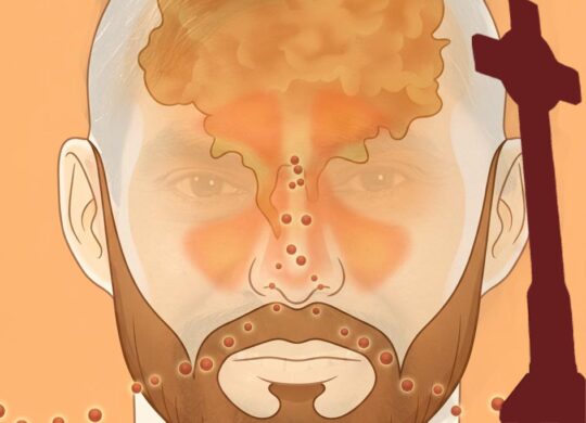 Pollution!